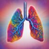 lung cancer